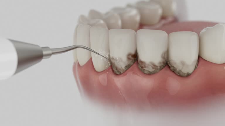 Trusted Tooth Extraction service in Troup, TX - Dentist Open Now